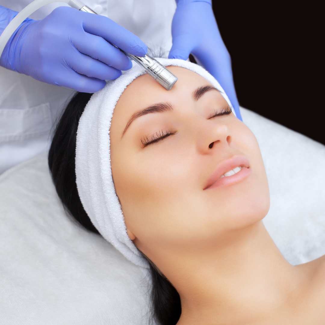 Microdermabrasion