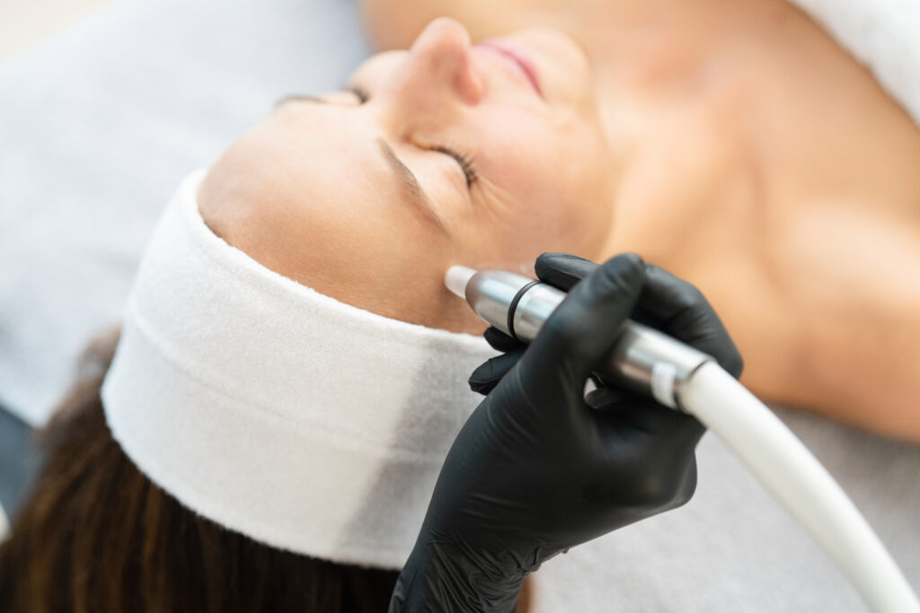 Microdermabrasion 4 im skinperfection kosmetikstudio dresden