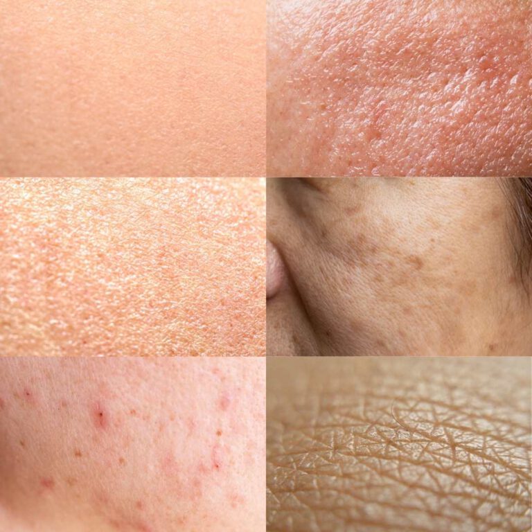 Hauttyp vs. Hautzustand