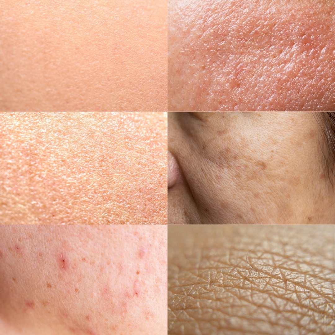 Hauttyp vs. Hautzustand