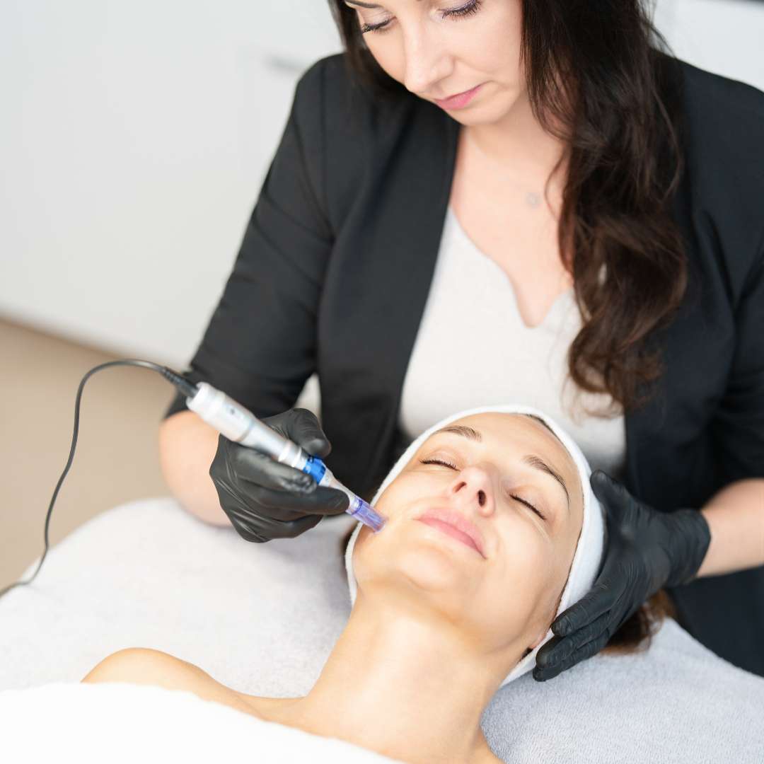 Microneedling Dresden